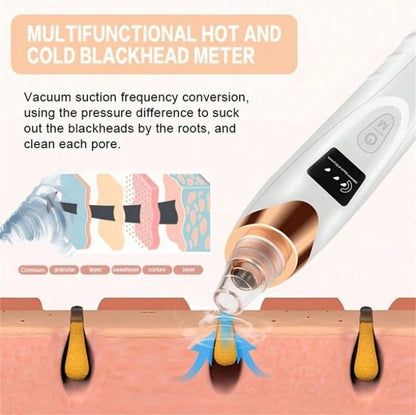 BLACK HEADS ACNE OIL REMOVER 5 in 1
